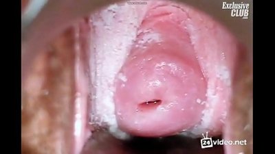 아름다운 여성의 부인과 검사